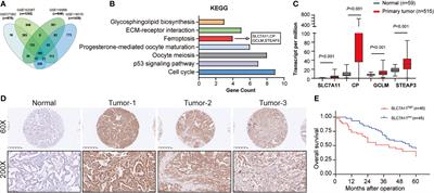 MiR-27a-3p Promotes Non-Small Cell Lung Cancer Through SLC7A11-Mediated-Ferroptosis